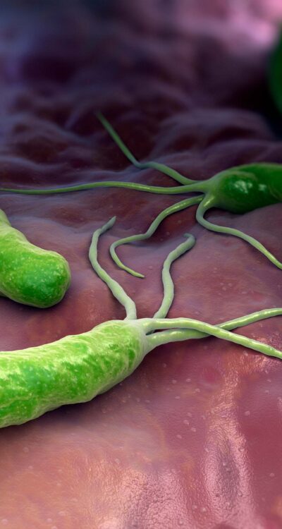 Imagen en 3D de las bacterias Helicobacter Pylori